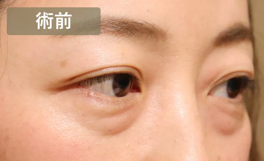 術前の画像