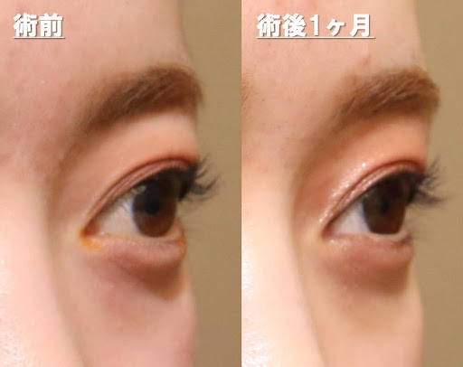 左眼に注目してください