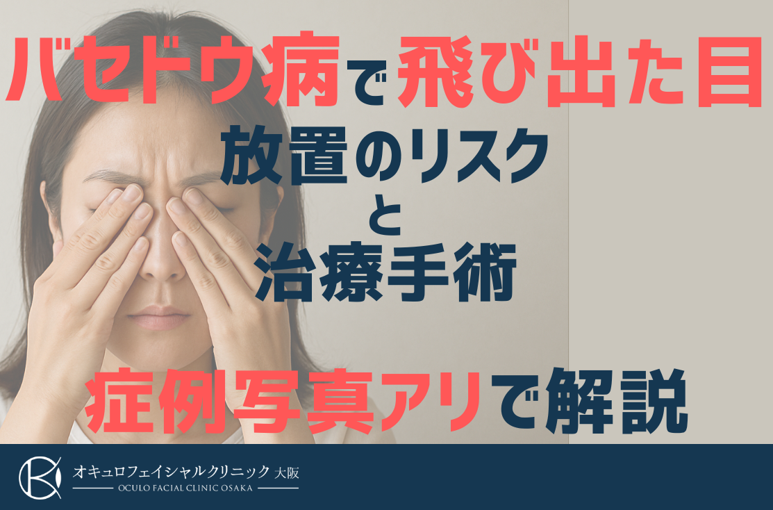 バセドウ病で眼球突出するのはなぜ？目が飛び出る原因と治療法を医師が解説