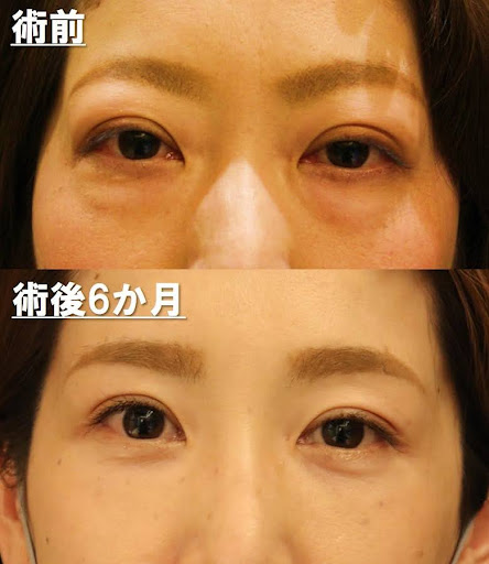 治療前後で顔つきが大きく異なります