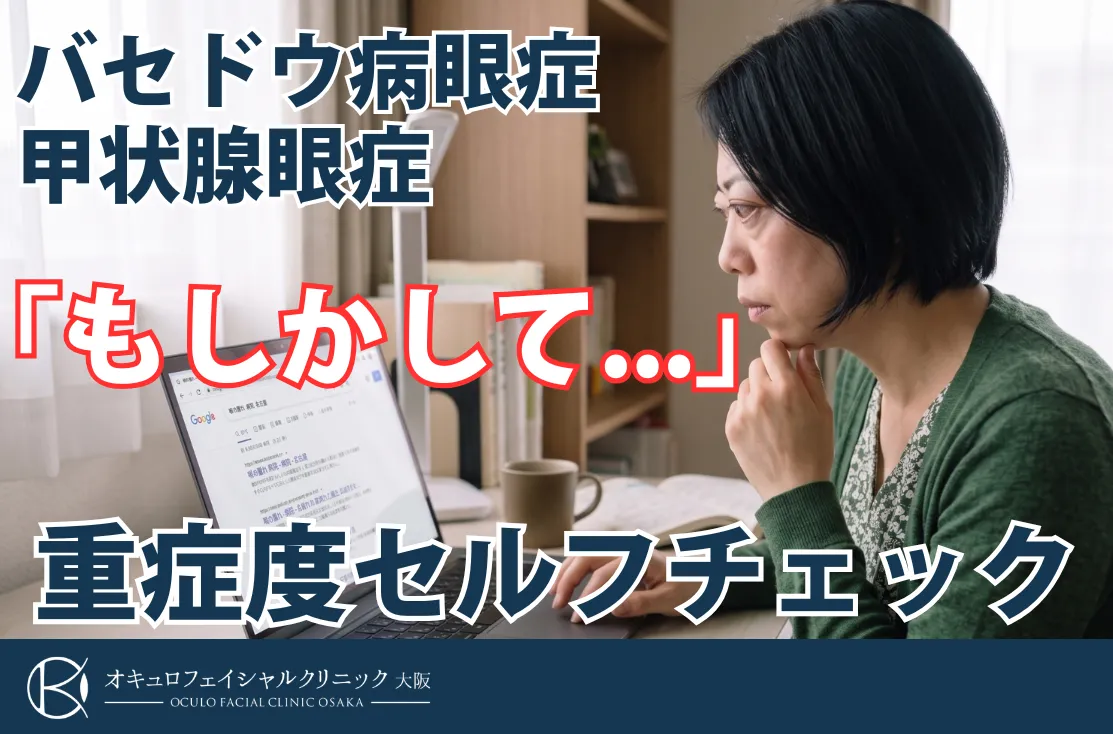 バセドウ病眼症・甲状腺眼症の重症度をセルフチェック｜眼球突出の診断基準と治療方法について解説